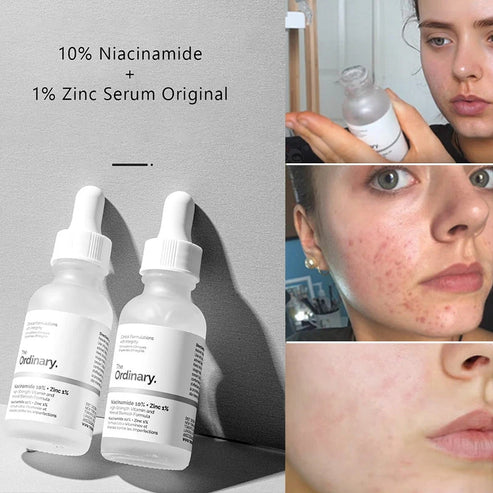 The Ordinary Niacinamide