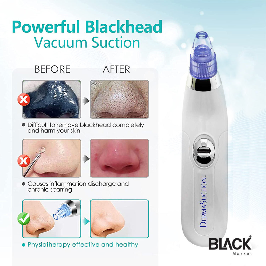 Deep Pore Vacuum