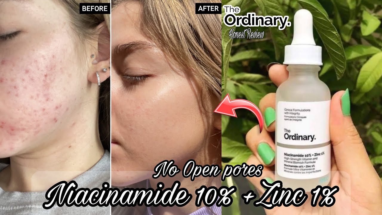 The Ordinary Niacinamide